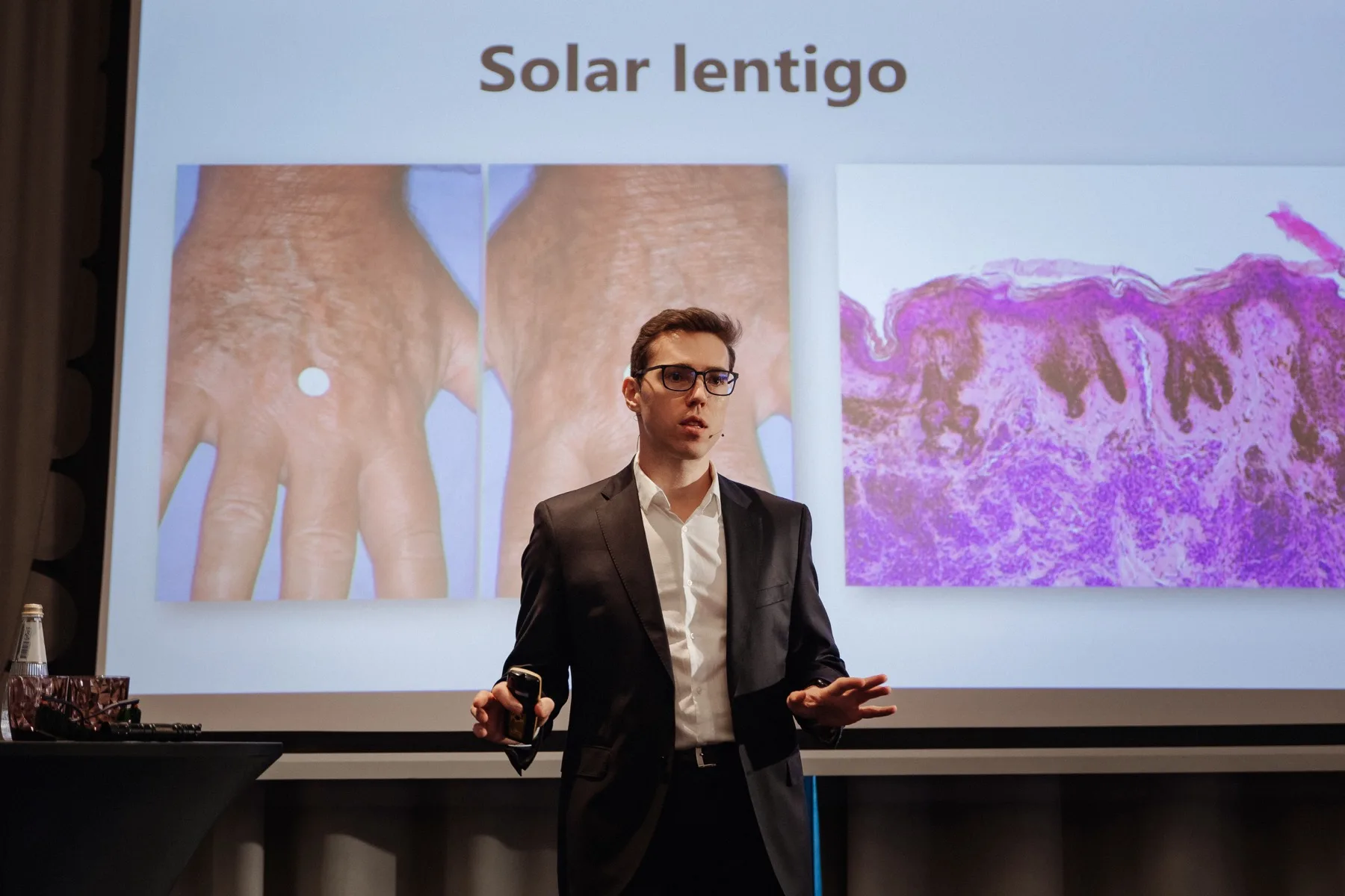 Clinical dermatology slide presentation at EHO International